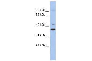 GADL1 antibody used at 1 ug/ml to detect target protein. (GADL1 anticorps  (Middle Region))