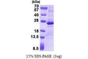 Figure annotation denotes ug of protein loaded and % gel used. (GREM1 Protéine)