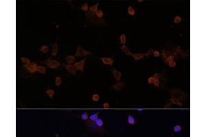Immunofluorescence analysis of NIH-3T3 cells using UBE2L3 Polyclonal Antibody at dilution of 1:100 (40x lens). (UBE2L3 anticorps)