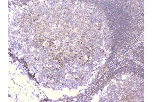 IHC analysis of PCDH15 using anti-PCDH15 antibody (ABIN6719362). (PCDH15 anticorps)