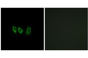 Immunofluorescence analysis of A549 cells, using CSTL1 antibody. (CSTL1 anticorps  (Internal Region))