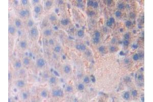 Used in DAB staining on fromalin fixed paraffin- embedded kidney tissue (Kallikrein 1 anticorps  (AA 21-261))