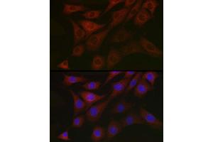 Immunofluorescence analysis of NIH/3T3 cells using PDK1/PDHK1 Rabbit pAb (ABIN3015351, ABIN3015352, ABIN1681301, ABIN5663787 and ABIN6214001) at dilution of 1:100 (40x lens).