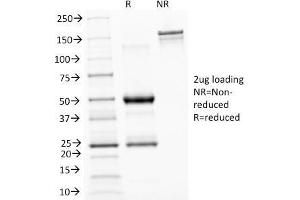 SDS-PAGE Analysis Purified ASRGL1 Mouse Monoclonal Antibody (CRASH/1289). (ASRGL1 anticorps)