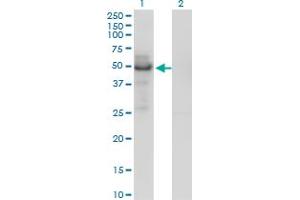 Western Blot analysis of PLTP expression in transfected 293T cell line by PLTP monoclonal antibody (M01), clone 2F3-G4. (PLTP anticorps  (AA 19-441))