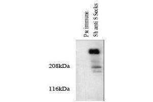 Image no. 1 for anti-A Kinase (PRKA) Anchor Protein 12 (AKAP12) antibody (ABIN296011)