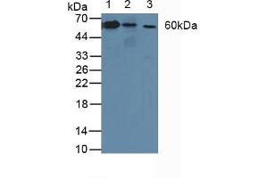 Figure. (ATP1B3 anticorps  (AA 61-273))