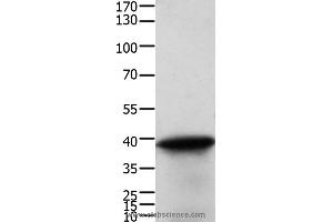 Western blot analysis of Human cervical cancer tissue, using TPM2 Polyclonal Antibody at dilution of 1:600 (TPM2 anticorps)