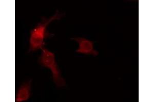 ABIN6276099 staining HuvEc by IF/ICC.