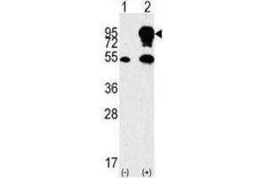 Western Blotting (WB) image for anti-Small Nuclear Ribonucleoprotein Polypeptide E (SNRPE) antibody (ABIN3003507) (SNRPE anticorps)