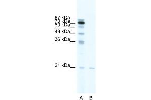 WB Suggested Anti-SCAND1 Antibody Titration:  0. (SCAND1 anticorps  (Middle Region))
