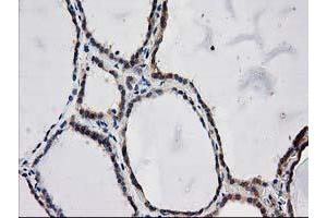 Image no. 15 for anti-ADP-Ribosylation Factor GTPase Activating Protein 1 (ARFGAP1) antibody (ABIN1496679) (ARFGAP1 anticorps)