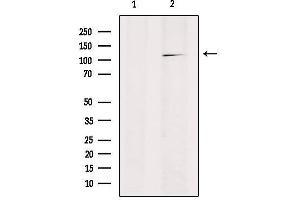 Western blot analysis of extracts from HepG2, using RANBP17 Antibody. (RANBP17 anticorps  (N-Term))
