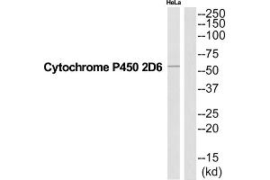 Western Blotting (WB) image for anti-Cytochrome P450, Family 2, Subfamily D, Polypeptide 6 (CYP2D6) (Internal Region) antibody (ABIN1852662) (CYP2D6 anticorps  (Internal Region))