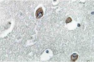 Immunohistochemistry (IHC) analyzes of NDUFB10 antibody in paraffin-embedded human brain tissue. (NDUFB10 anticorps)