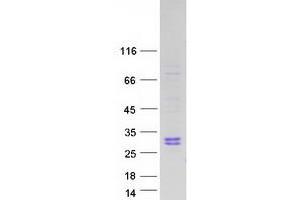 Validation with Western Blot