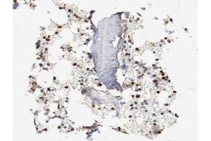 ABIN6266478 at 1/200 staining human Bone marrow tissue sections by IHC-P. (CEBPE anticorps  (Internal Region))