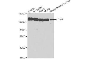 Western blot analysis of extracts of various cell lines, using COMP antibody. (COMP anticorps  (AA 20-160))