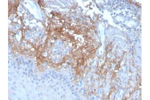 Formalin-fixed, paraffin-embedded human Skin stained with Decorin Mouse Monoclonal Antibody (DCN/3523).