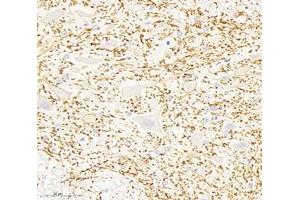 Immunohistochemistry analysis of paraffin-embedded rat spinal cord using,KCC2 (ABIN7075650) at dilution of 1: 1800 (KCC2 anticorps)