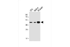 All lanes : Anti-STRADA Antibody (C-term) at 1:1000 dilution Lane 1: 293 whole cell lysate Lane 2: Molt-4 cell lysate Lane 3: Mouse brain lysate Lysates/proteins at 20 μg per lane.