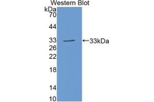 WB of Protein Standard: different control antibodies against Highly purified E.