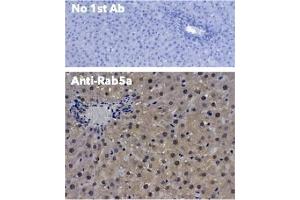 Immunohistochemistry (IHC) image for anti-RAB5A, Member RAS Oncogene Family (RAB5A) (C-Term) antibody (ABIN1439994)