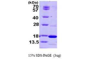 SDS-PAGE (SDS) image for phosphodiesterase 6D, CGMP-Specific, Rod, delta (PDE6D) (AA 1-150) protein (His tag) (ABIN667785)