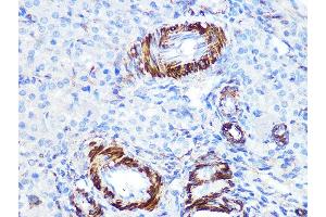 Immunohistochemistry of paraffin-embedded rat ovary using Caldesmon Rabbit mAb (ABIN7266024) at dilution of 1:100 (40x lens). (Caldesmon anticorps)