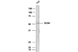 Raji cell lysates probed with Anti-SGSH/Sulphamidase Polyclonal Antibody, Unconjugated (ABIN1386573) at 1:300 in 4˚C.