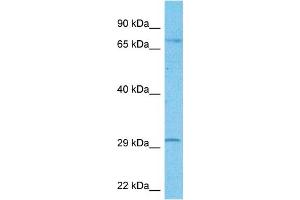 Host:  Rabbit  Target Name:  FOXR2  Sample Type:  U937 Whole Cell lysates  Antibody Dilution:  1. (FOXR2 anticorps  (Middle Region))