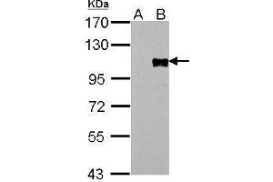 WB Image FOXM1 antibody detects FOXM1 protein by Western blot analysis. (FOXM1 anticorps)