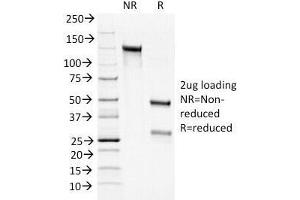 SDS-PAGE Analysis of Purified, BSA-Free Bcl2 Antibody cocktail (100/D5 + 124). (Bcl-2 anticorps  (AA 41-54))