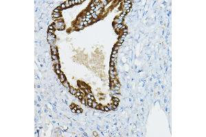 Immunohistochemistry of paraffin-embedded Human hepatobiliary duct using IR Rabbit pAb (ABIN6130499, ABIN6142522, ABIN6142523 and ABIN6221797) at dilution of 1:50 (40x lens).