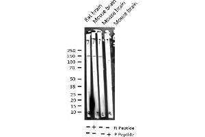 Western blot analysis of Phospho-ASK1 (Ser966) expression in various lysates (ASK1 anticorps  (pSer966))