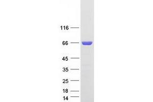 Validation with Western Blot