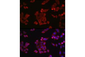 Immunofluorescence analysis of HeLa cells using Cyclin B1 Rabbit pAb (ABIN3022806, ABIN3022807, ABIN3022808 and ABIN6219237) at dilution of 1:150 (40x lens). (Cyclin B1 anticorps  (C-Term))