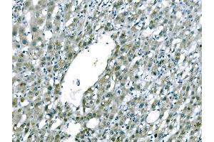 IHC analysis of CD101 using anti-CD101 antibody (ABIN7601981). (CD101 anticorps  (AA 53-904))