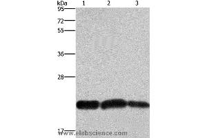 Western blot analysis of A375 and Raji cell, human fetal brain tissue, using CBX3 Polyclonal Antibody at dilution of 1:600 (CBX3 anticorps)