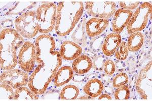 Immunohistochemistry of paraffin-embedded Human kidney using Pck1 Polyclonal Antibody at dilution of 1:100 (PCK1 anticorps)