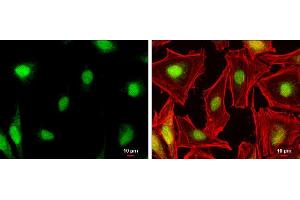ICC/IF Image NR0B1 antibody detects NR0B1 protein at nucleus by immunofluorescent analysis. (NR0B1 anticorps)