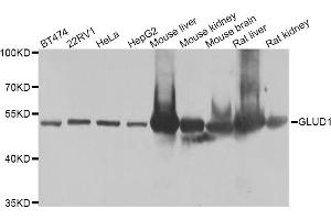 Western blot analysis of extracts of various cell lines, using GLUD1 antibody (ABIN5975614) at 1/1000 dilution.