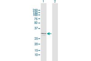 Western Blot analysis of FCN2 expression in transfected 293T cell line by FCN2 MaxPab polyclonal antibody.