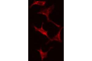 ABIN6274824 staining Hela cells by IF/ICC.