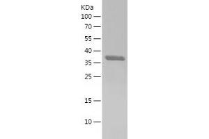 HBS1-Like (HBS1L) (AA 1-80) protein (His-IF2DI Tag)