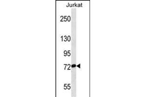 RP3 Antibody (Center) (ABIN1538291 and ABIN2849786) western blot analysis in Jurkat cell line lysates (35 μg/lane). (RPAP3 anticorps  (AA 311-338))