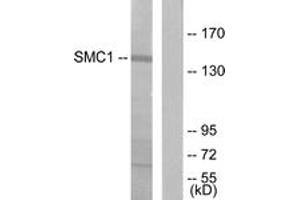 Western blot analysis of extracts from 293 cells, treated with UV 15', using SMC1 (Ab-957) Antibody. (SMC1A anticorps  (AA 931-980))