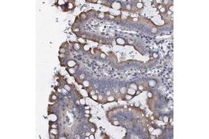 Immunohistochemical staining of human small intestine with PRHOXNB polyclonal antibody  shows moderate cytoplasmic positivity in glandular cells at 1:500-1:1000 dilution. (Ureidoimidazoline (2-Oxo-4-Hydroxy-4-Carboxy-5-) Decarboxylase (URAD) anticorps)