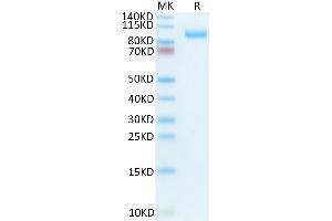 Biotinylated Mouse CDCP1 on Tris-Bis PAGE under reduced condition. (CDCP1 Protein (AA 25-667) (His-Avi Tag,Biotin))