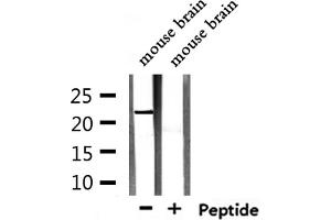 Western blot analysis of extracts from mouse brain, using TCEAL5 Antibody. (TCEAL5 anticorps  (Internal Region))